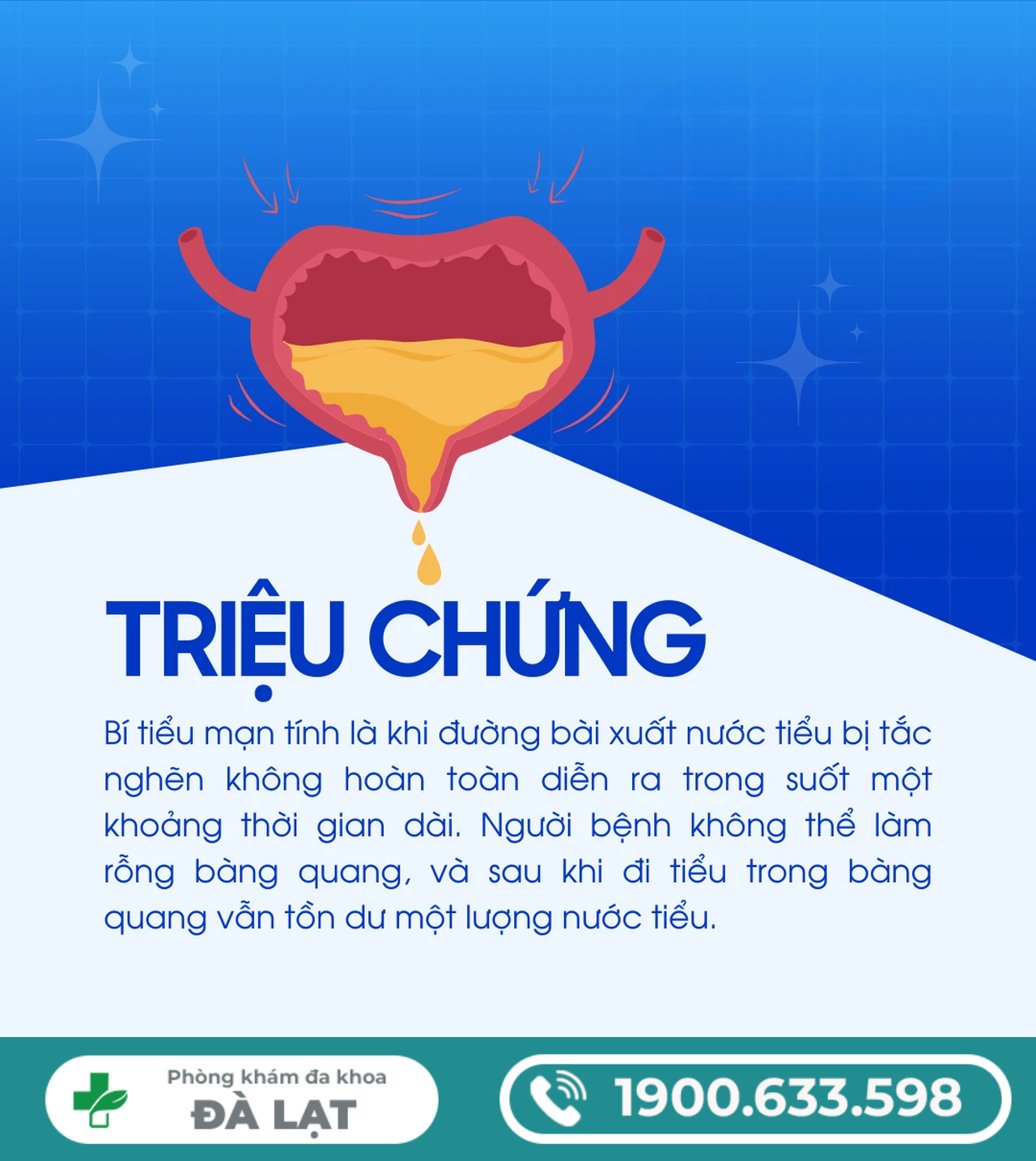 Hình ảnh minh họa